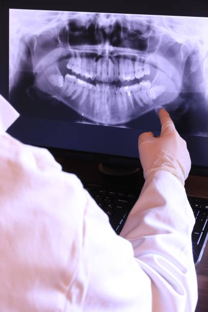 Best Dental Abscess Treatment in Clayton, NJ